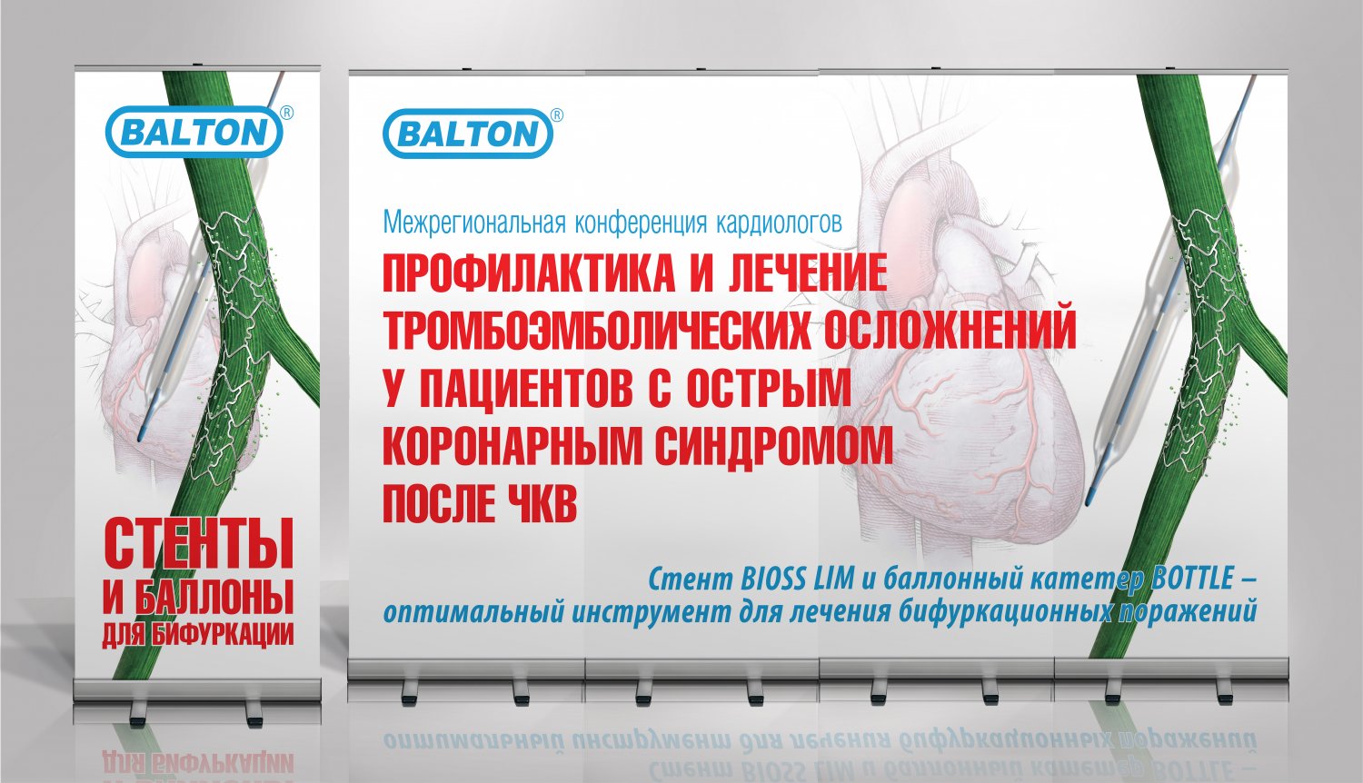 Комплект ролл-апов для Межрегиональной конференции «Профилактика и лечение тромбоэмболических осложнений у пациентов с острым коронарным синдромом после ЧКВ» по заказу Торгового дома БМБ — фото 2